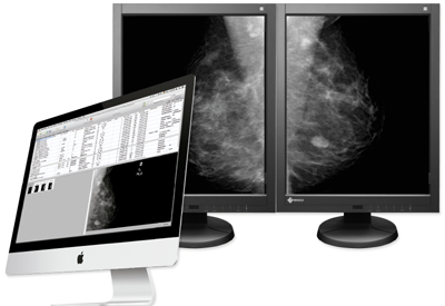 mammography_workstation_aycan