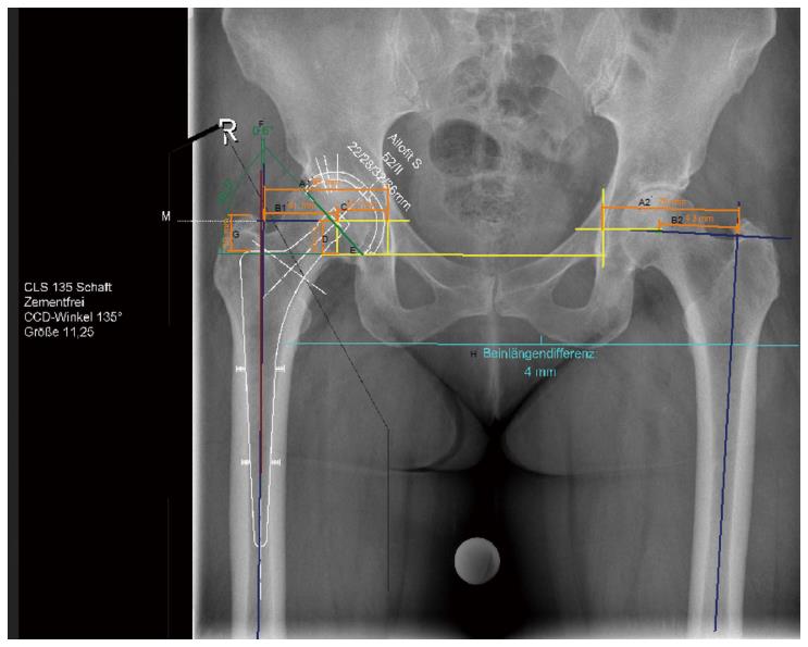 orthoview_digital